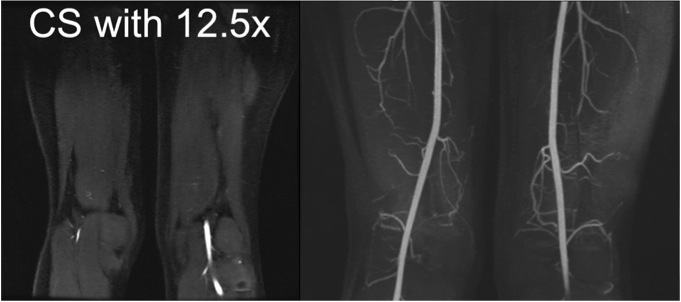 Fast MRI techniques